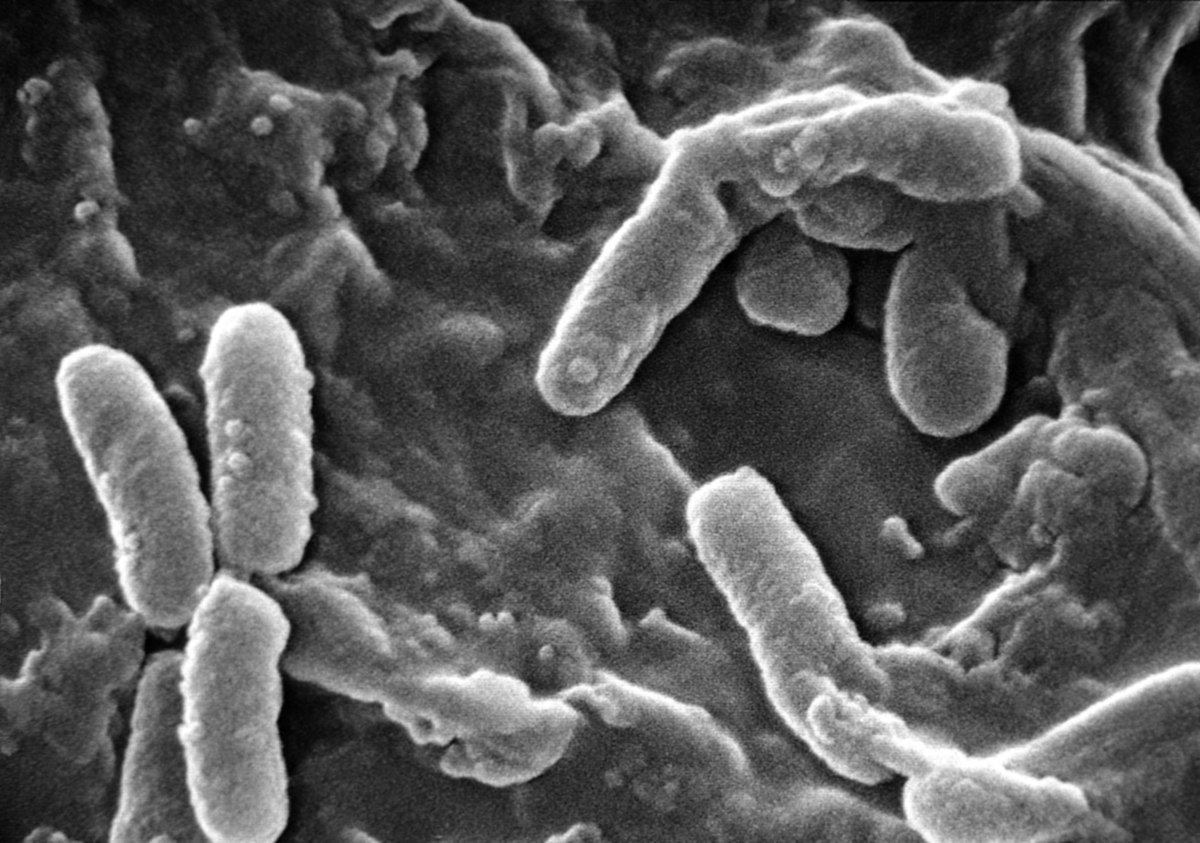 Hastane Plastiklerini Parçalayıp Besin Olarak Kullanan Bakteri Keşfedildi