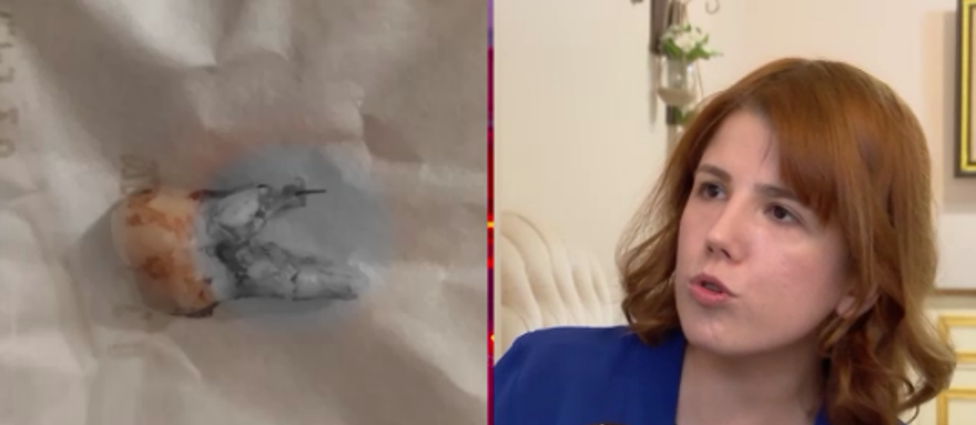 Kanal Tedavisinde Metal Parça Unuttular